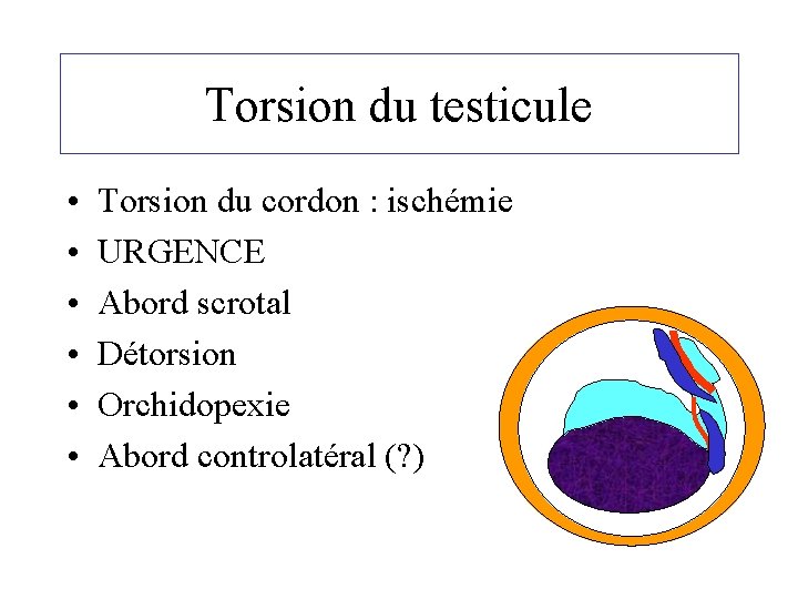 Torsion du testicule • • • Torsion du cordon : ischémie URGENCE Abord scrotal