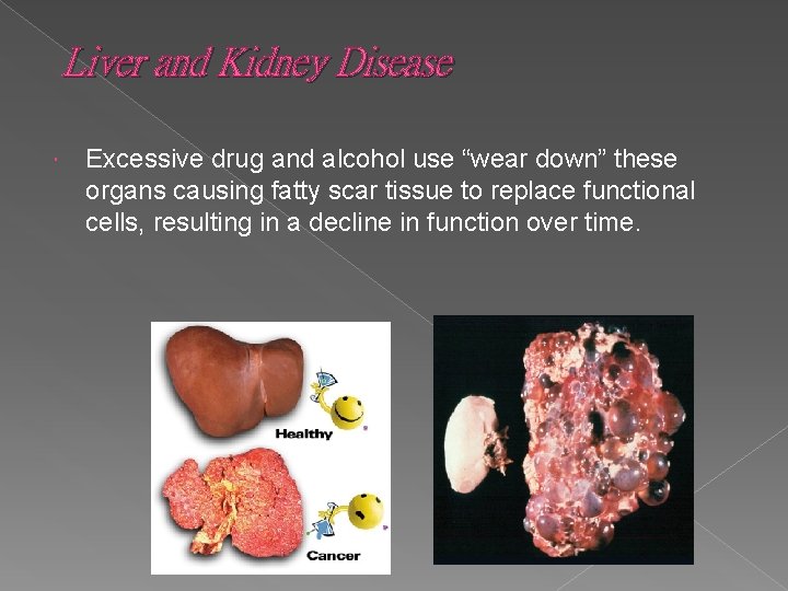 Liver and Kidney Disease Excessive drug and alcohol use “wear down” these organs causing