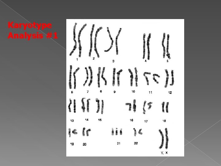 Karyotype Analysis #1 