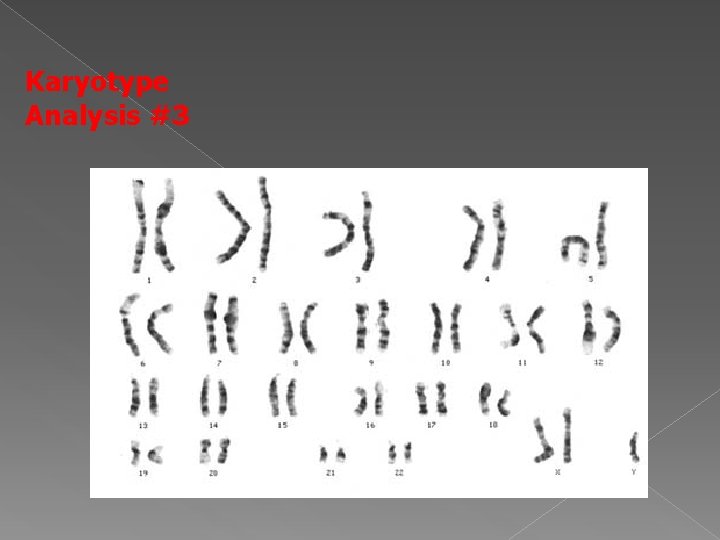 Karyotype Analysis #3 