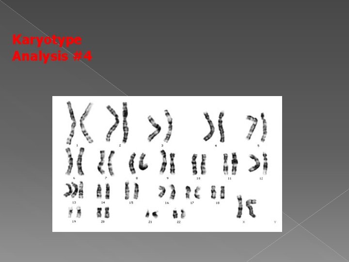 Karyotype Analysis #4 