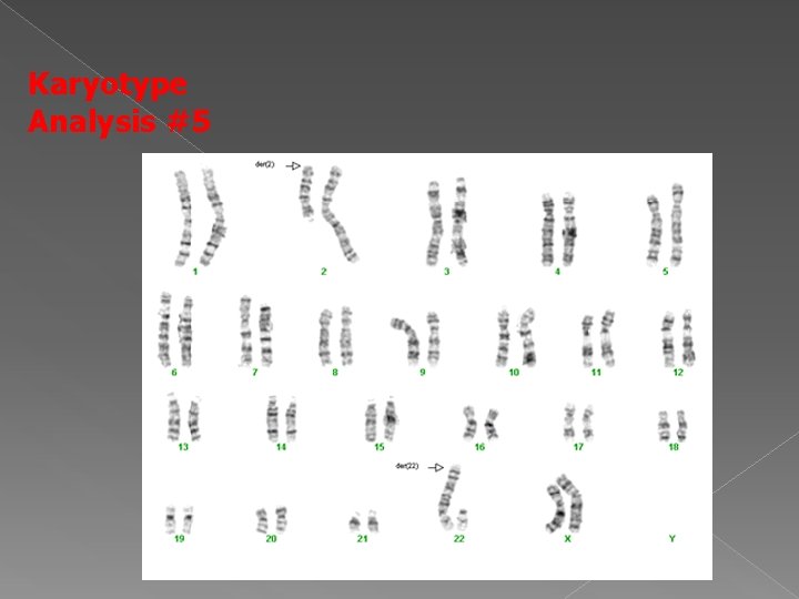 Karyotype Analysis #5 