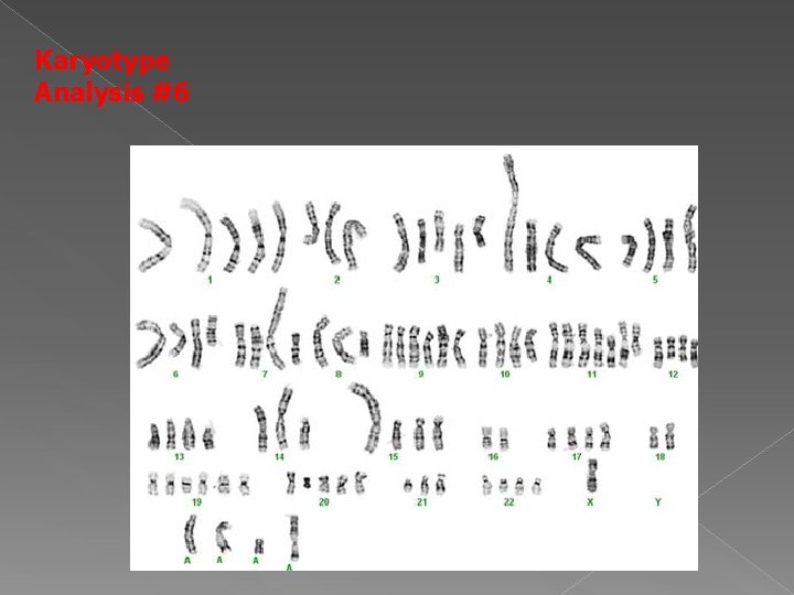 Karyotype Analysis #6 