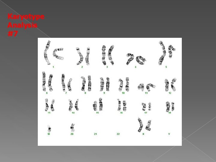 Karyotype Analysis #7 