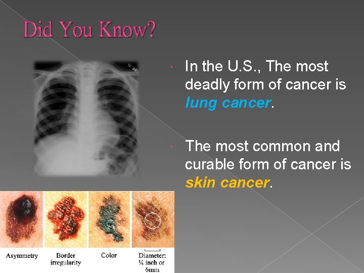 Did You Know? In the U. S. , The most deadly form of cancer