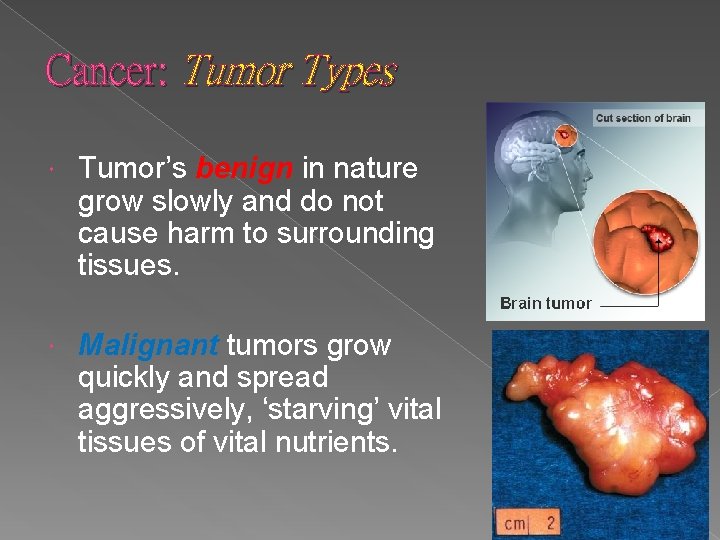 Cancer: Tumor Types Tumor’s benign in nature grow slowly and do not cause harm