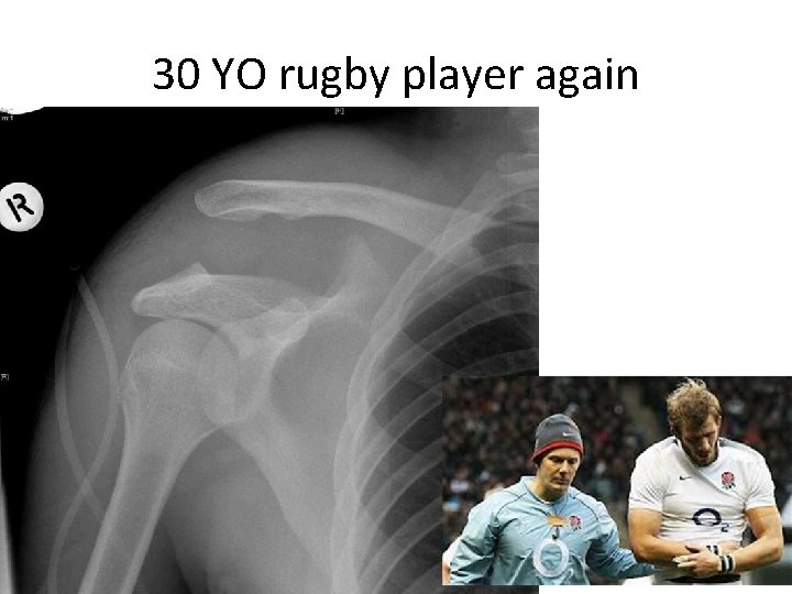 30 YO rugby player again 