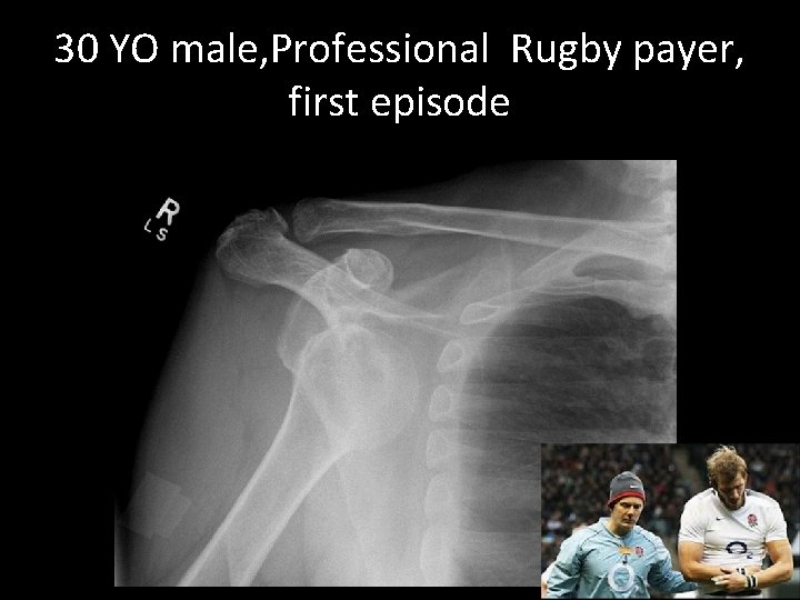 30 YO male, Professional Rugby payer, first episode 