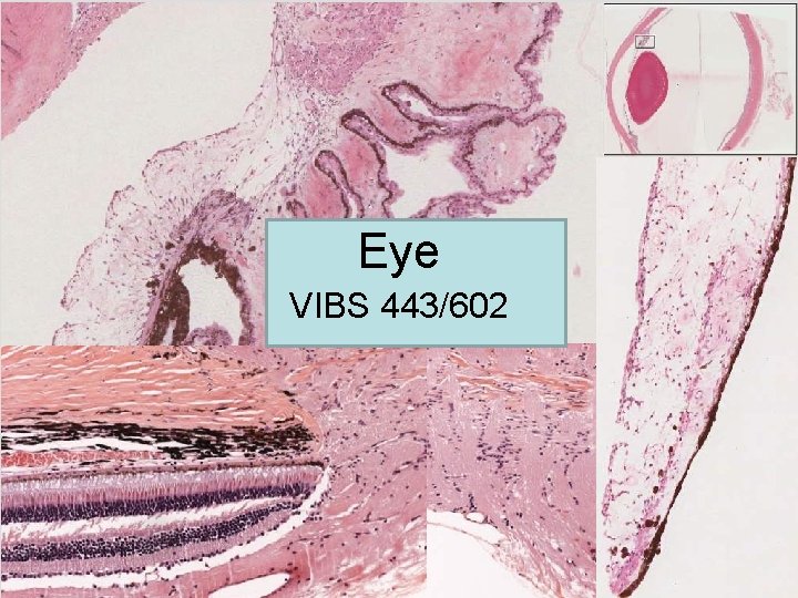 Eye VIBS 443/602 