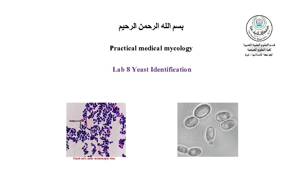  ﺑﺴﻢ ﺍﻟﻠﻪ ﺍﻟﺮﺣﻤﻦ ﺍﻟﺮﺣﻴﻢ Practical medical mycology Lab 8 Yeast Identification 