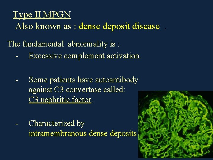 Type II MPGN Also known as : dense deposit disease. The fundamental abnormality is