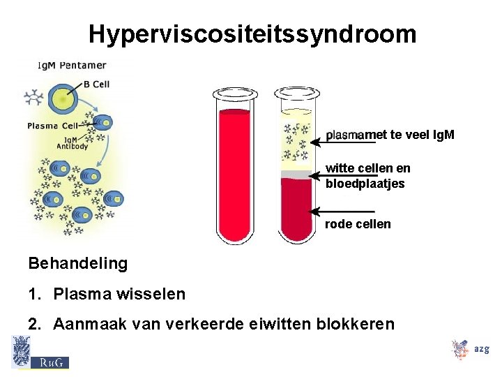 Hyperviscositeitssyndroom met te veel Ig. M witte cellen en bloedplaatjes rode cellen Behandeling 1.