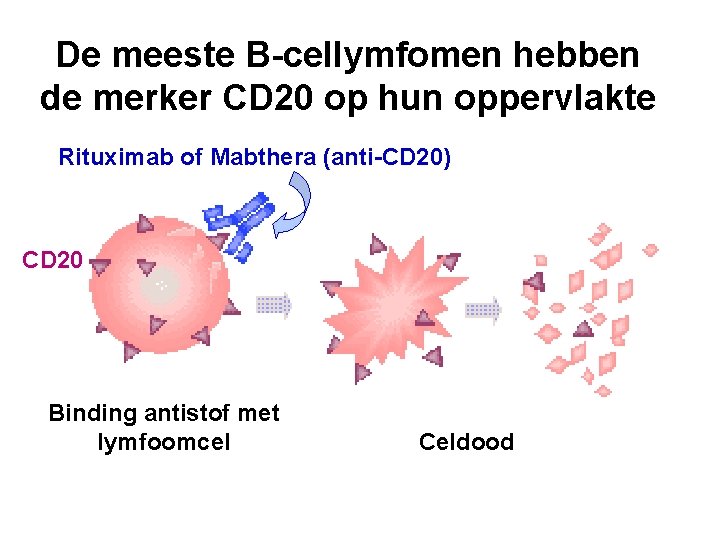 De meeste B-cellymfomen hebben de merker CD 20 op hun oppervlakte Rituximab of Mabthera