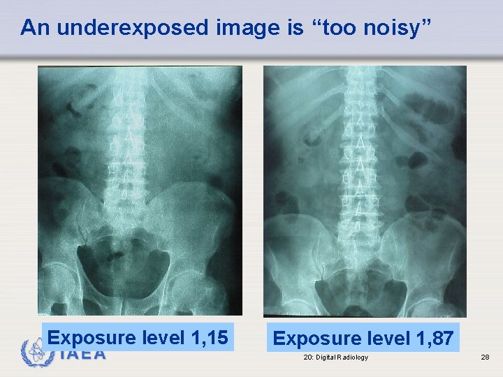 An underexposed image is “too noisy” Exposure level 1, 15 IAEA Exposure level 1,