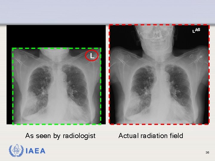 As seen by radiologist IAEA Actual radiation field 36 