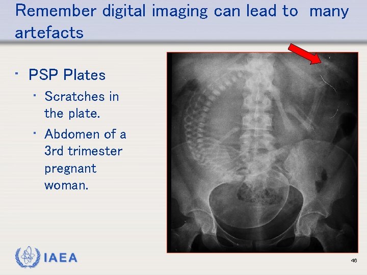 Remember digital imaging can lead to many artefacts • PSP Plates • Scratches in