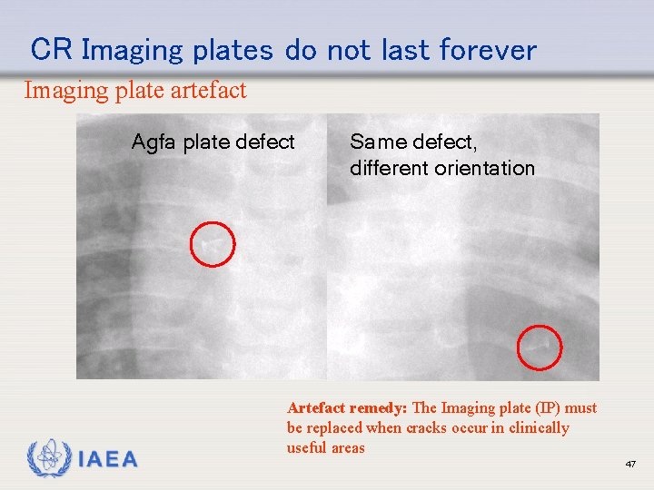CR Imaging plates do not last forever Imaging plate artefact Agfa plate defect IAEA