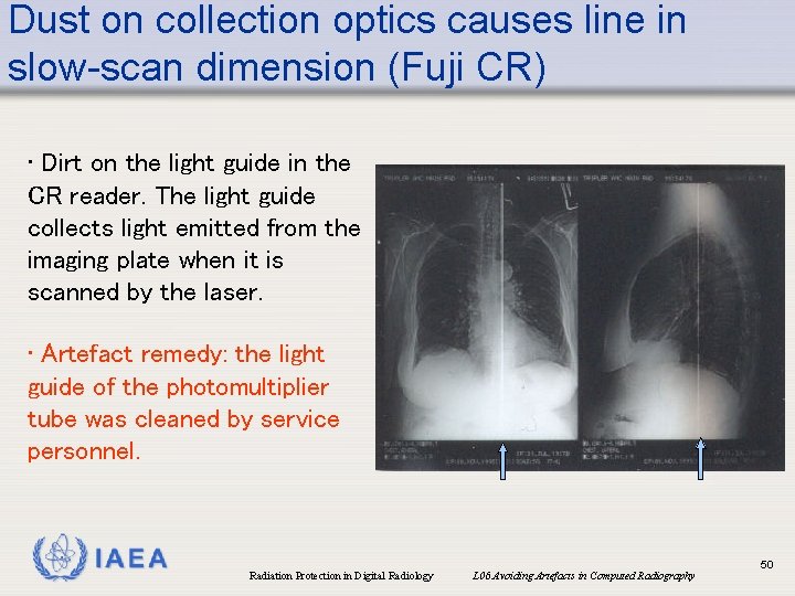 Dust on collection optics causes line in slow-scan dimension (Fuji CR) • Dirt on