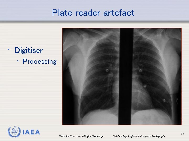 Plate reader artefact • Digitiser • Processing IAEA Radiation Protection in Digital Radiology L