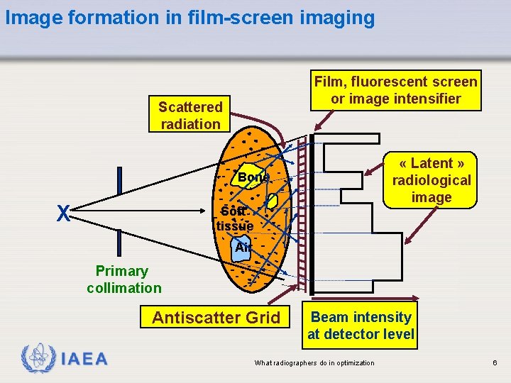 Image formation in film-screen imaging Film, fluorescent screen or image intensifier Scattered radiation «