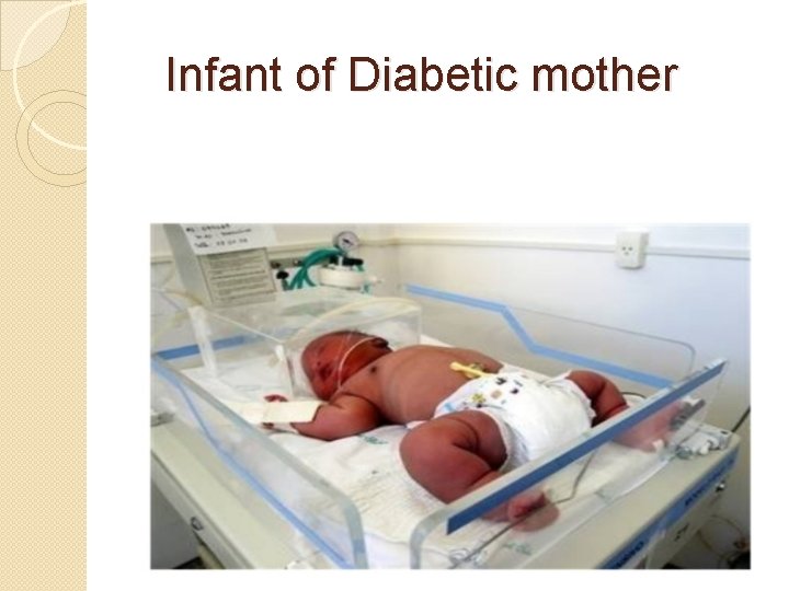 Infant of Diabetic mother 