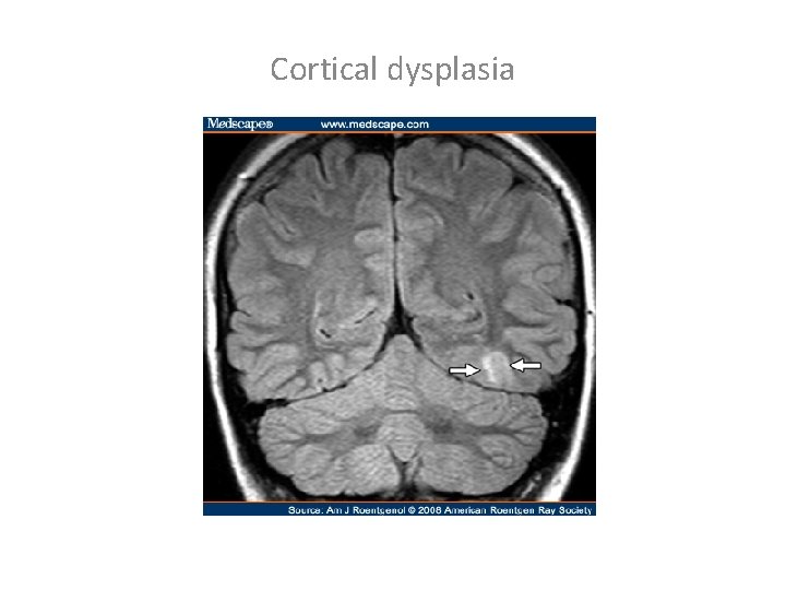 Ventricles of the Brain DR T AJAYAN PROF