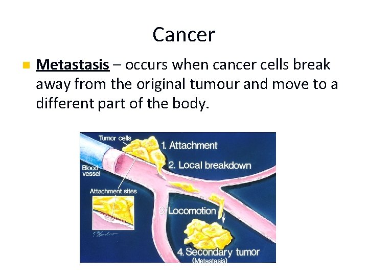 Cancer n Metastasis – occurs when cancer cells break away from the original tumour