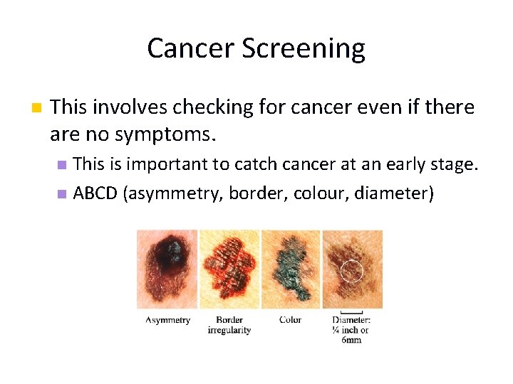 Cancer Screening n This involves checking for cancer even if there are no symptoms.