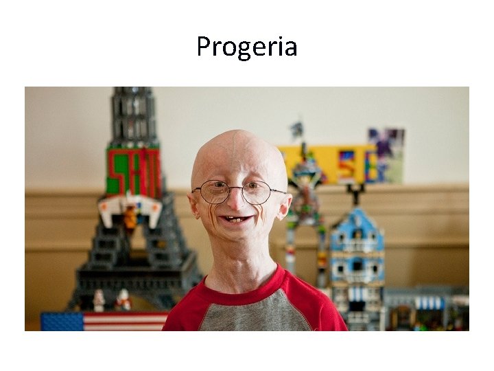 Progeria 