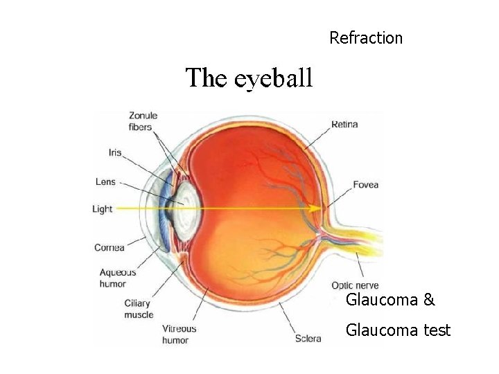 Refraction Glaucoma & Glaucoma test 