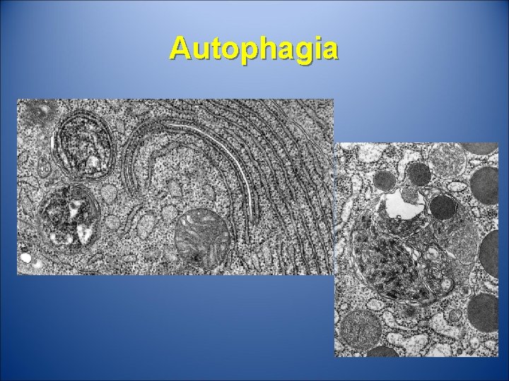 Autophagia 