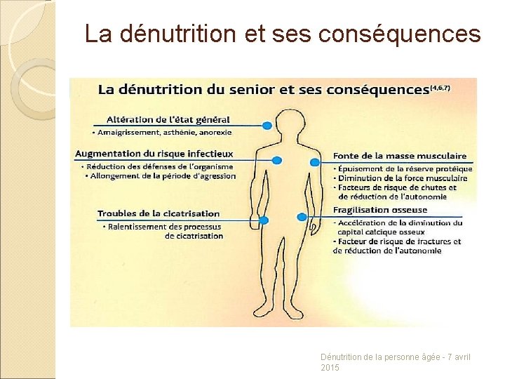 La dénutrition et ses conséquences Dénutrition de la personne âgée - 7 avril 2015