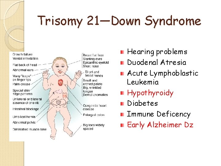 Trisomy 21—Down Syndrome Hearing problems Duodenal Atresia Acute Lymphoblastic Leukemia Hypothyroidy Diabetes Immune Deficency Trisomy 21—Down Syndrome Hearing problems Duodenal Atresia Acute Lymphoblastic Leukemia Hypothyroidy Diabetes Immune Deficency