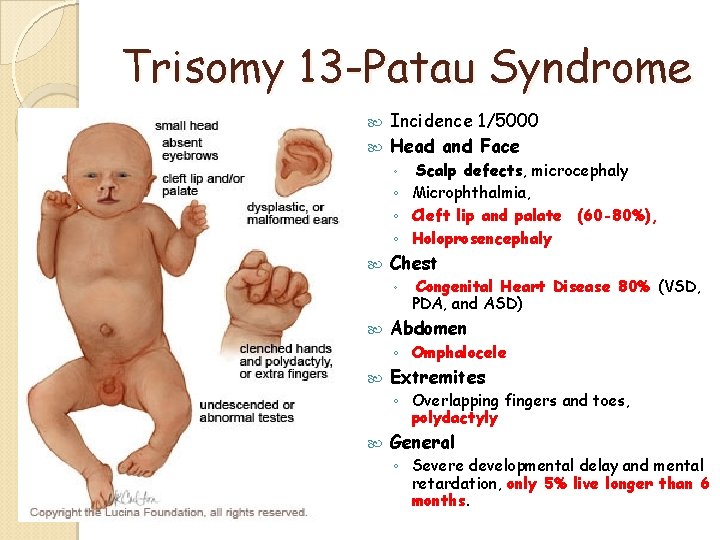 Trisomy 13 -Patau Syndrome Incidence 1/5000 Head and Face Scalp defects, microcephaly ◦ Microphthalmia, Trisomy 13 -Patau Syndrome Incidence 1/5000 Head and Face Scalp defects, microcephaly ◦ Microphthalmia,