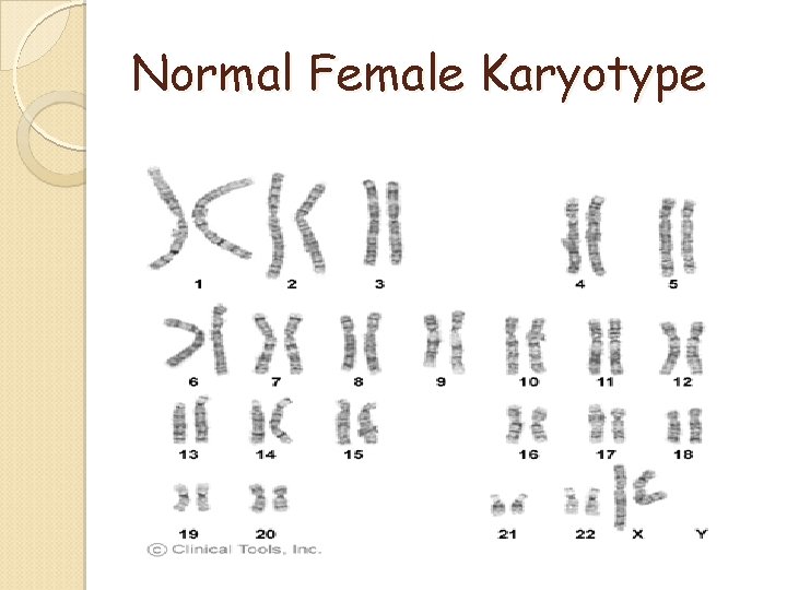 Normal Female Karyotype Normal Female Karyotype