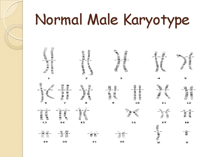 Normal Male Karyotype Normal Male Karyotype
