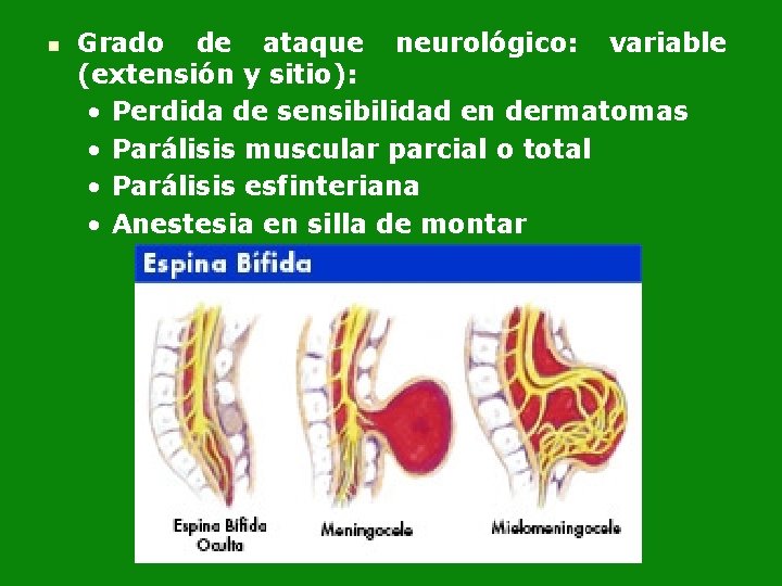 n Grado de ataque neurológico: variable (extensión y sitio): • Perdida de sensibilidad en