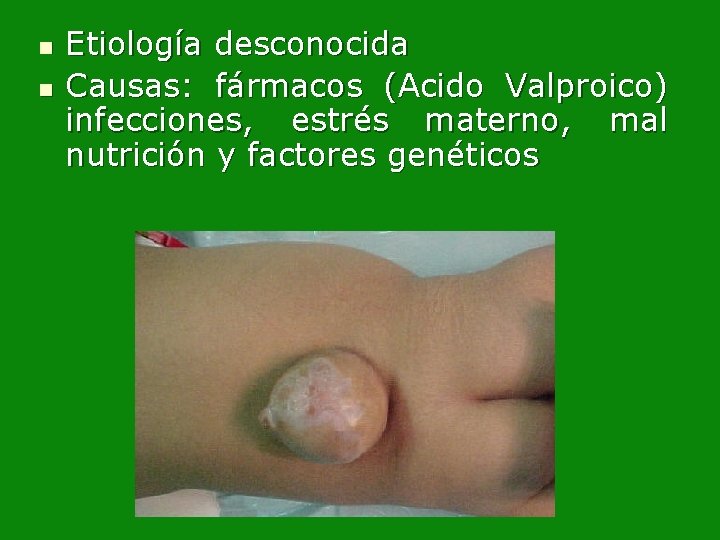 n n Etiología desconocida Causas: fármacos (Acido Valproico) infecciones, estrés materno, mal nutrición y