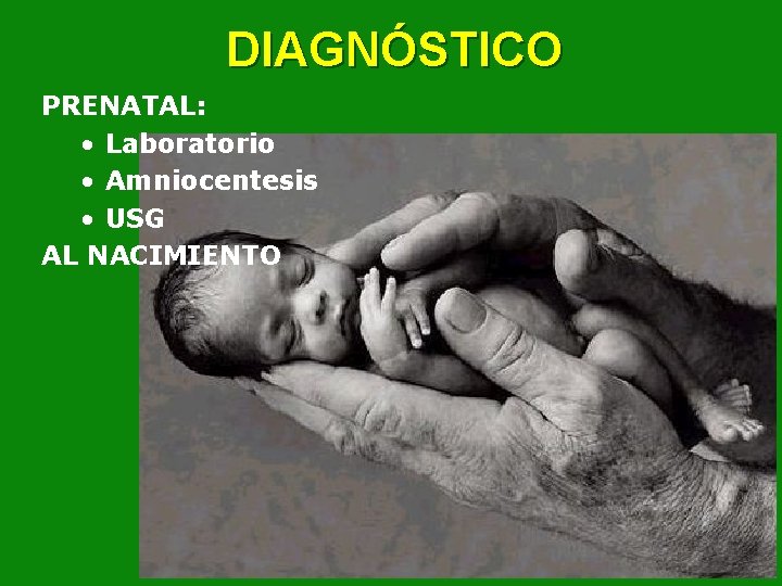 DIAGNÓSTICO PRENATAL: • Laboratorio • Amniocentesis • USG AL NACIMIENTO 