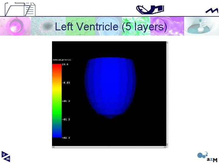 Left Ventricle (5 layers) 