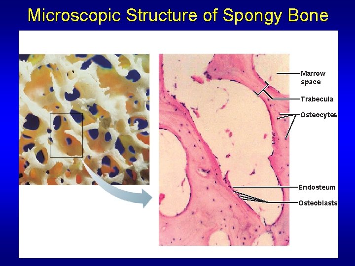 Microscopic Structure of Spongy Bone Marrow space Trabecula Osteocytes Endosteum Osteoblasts 