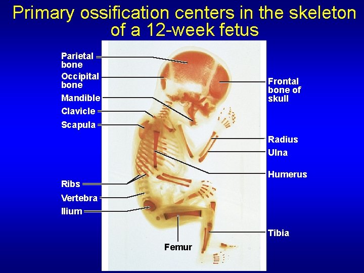 Primary ossification centers in the skeleton of a 12 -week fetus Parietal bone Occipital