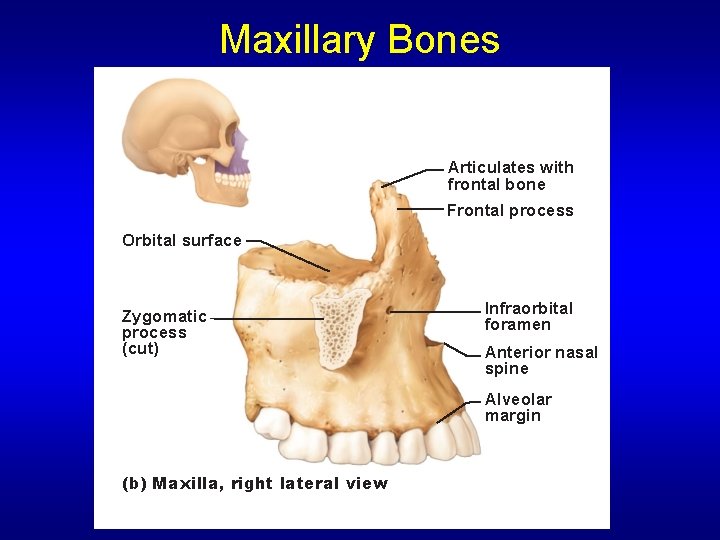 Maxillary Bones Articulates with frontal bone Frontal process Orbital surface Zygomatic process (cut) Infraorbital