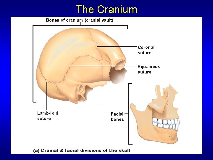 The Cranium Bones of cranium (cranial vault) Coronal suture Squamous suture Lambdoid suture Facial