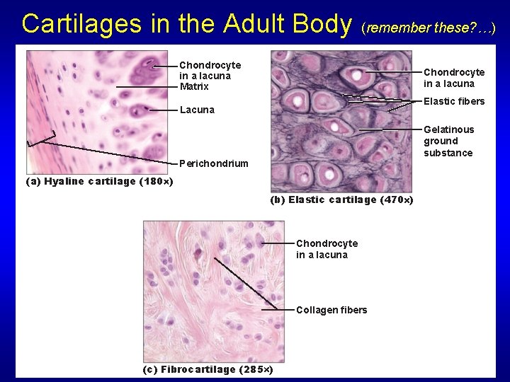 Cartilages in the Adult Body (remember these? …) Chondrocyte in a lacuna Matrix Chondrocyte