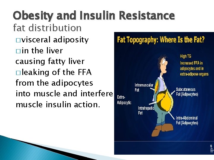 Obesity and Insulin Resistance fat distribution � visceral adiposity � in the liver causing