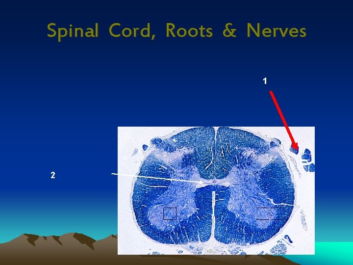 Spinal Cord, Roots & Nerves 1 2 