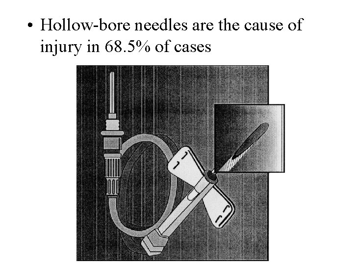  • Hollow-bore needles are the cause of injury in 68. 5% of cases
