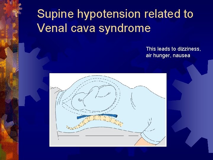 Supine hypotension related to Venal cava syndrome This leads to dizziness, air hunger, nausea