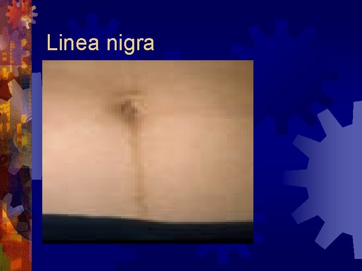 Linea nigra 